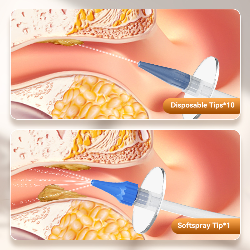 Ear Wax Removal Manual Ear Irr - Smart Garden Watering System incelemesi ve fiyatı